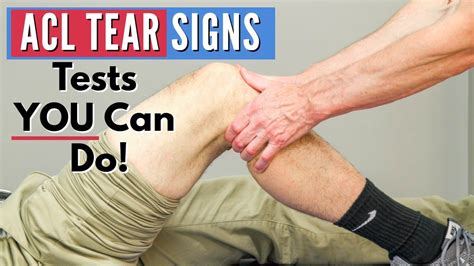 acl tear diagnostic tests|signs of a torn acl.